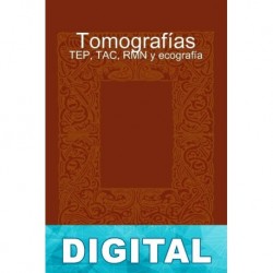 Tomografías - TEP, TAC, RMN y ecografía Pedro Gómez-Esteban González