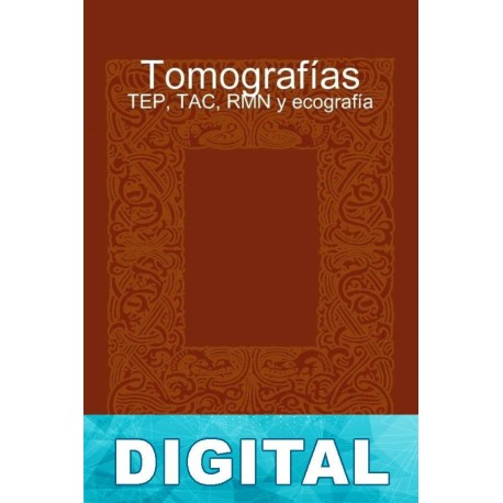 Tomografías - TEP, TAC, RMN y ecografía Pedro Gómez-Esteban González