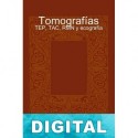 Tomografías - TEP, TAC, RMN y ecografía Pedro Gómez-Esteban González